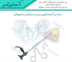 جراحی آندوسکوپی بینی و سینوس و هیپوفیز