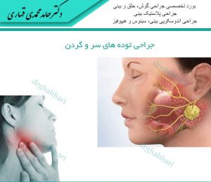 جراحی توده های سر و گردن