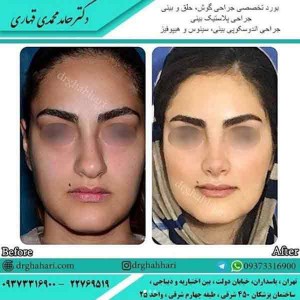 عمل بینی فانتزی