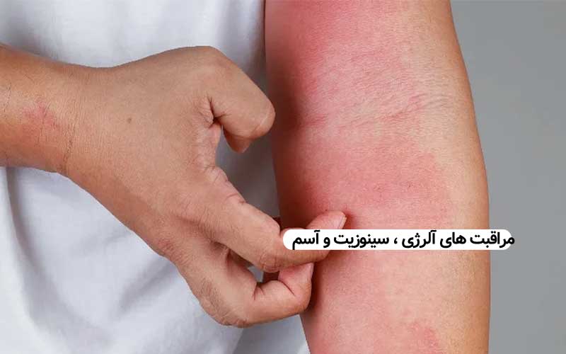 مراقبت های آلرژی سینوزیت و آسم