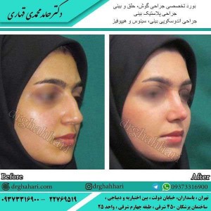 جراح پلاستیک بینی