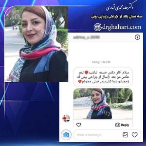 عمل زیبایی بینی در تهران