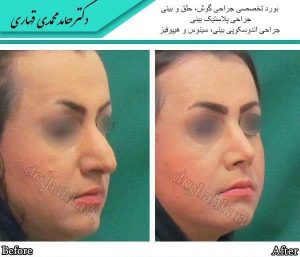 بهترین جراح بینی تهران