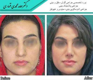جراح بینی عالی در تهران
