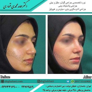 جراح بینی عالی در تهران