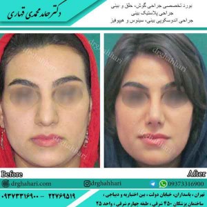 جراح بینی عالی در تهران