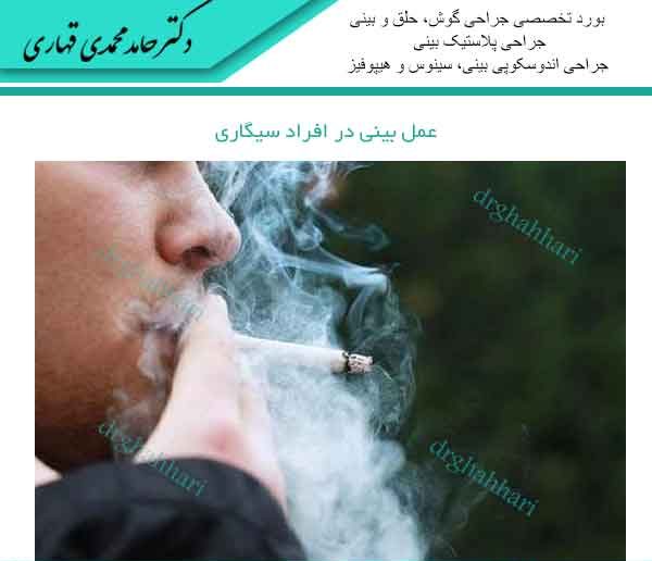 عمل بینی در افراد سیگاری