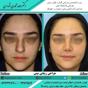 جراح بینی تهران