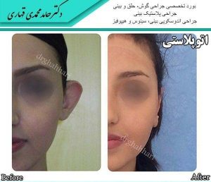 جراح پلاستیک بینی و صورت