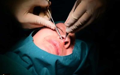 جراح پلاستیک بینی و صورت