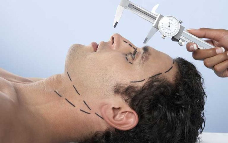 مراقبت های قبل از عمل بینی