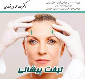 پیشانی 3 e1696673216214