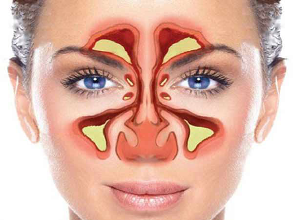 مراقبت جراحی اندوسکوپی بینی و سینوس