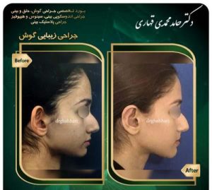 جراحی گوش در تهران - دکتر قهاری