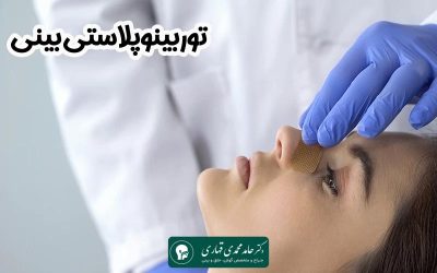 توربینوپلاستی بینی چیست