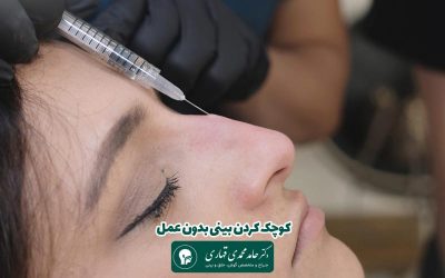 کوچک کردن بینی بدون عمل