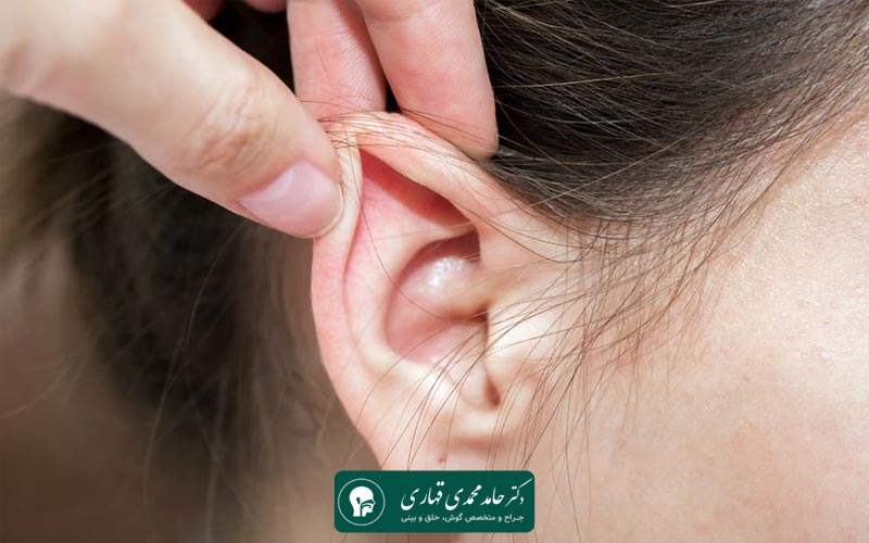 مراقبت بعد از عمل گوش برجسته