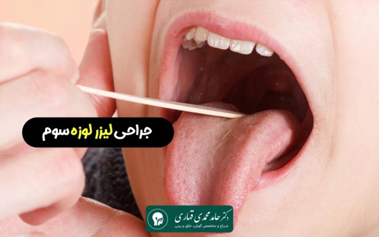 جراحی لیزر لوزه سوم
