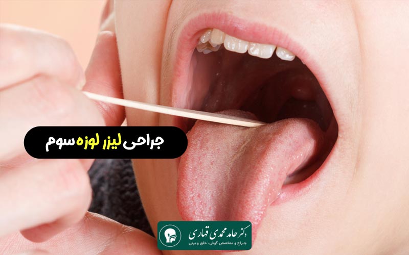 جراحی لیزر لوزه سوم