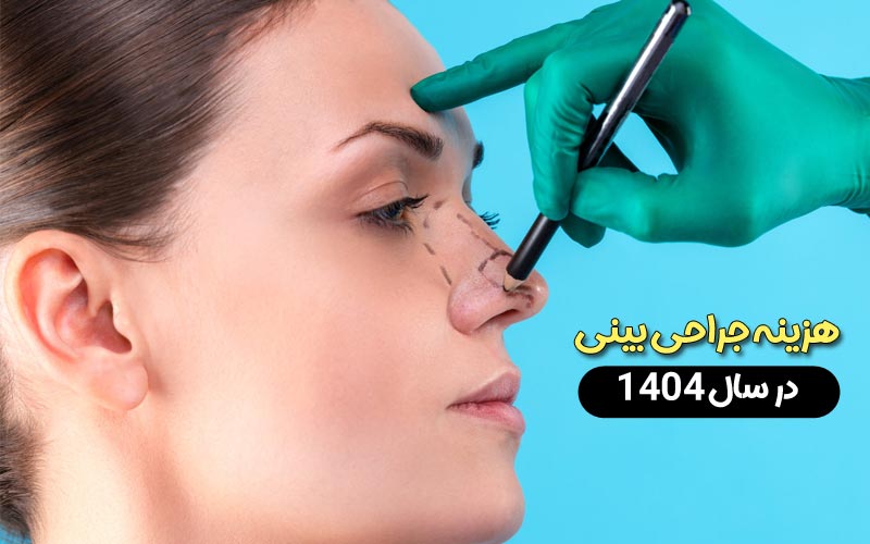 هزینه عمل بینی در سال 1404