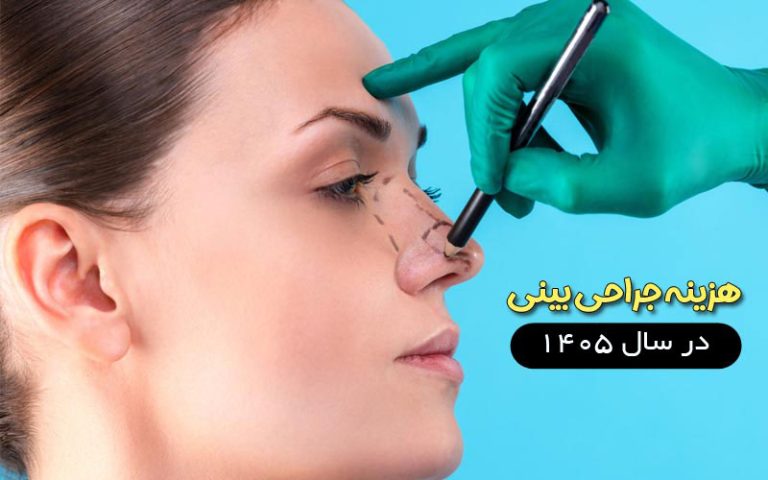 هزینه عمل بینی در سال 1405