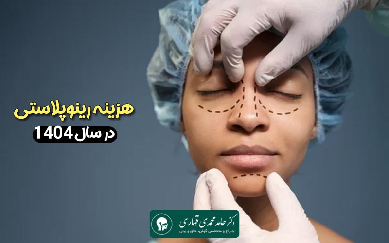 هزینه رینوپلاستی در سال 1404