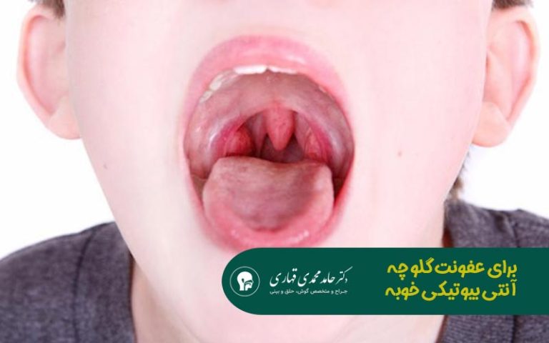 برای عفونت گلو چه آنتی بیوتیکی خوبه