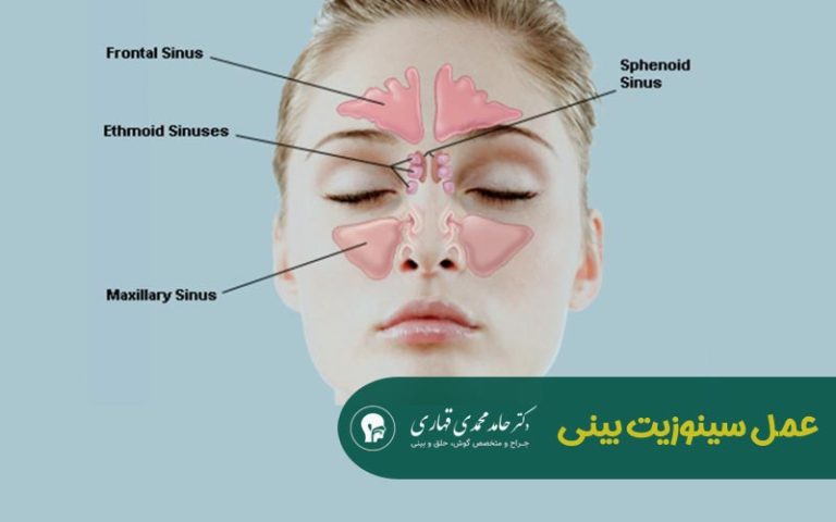 عمل سینوزیت بینی