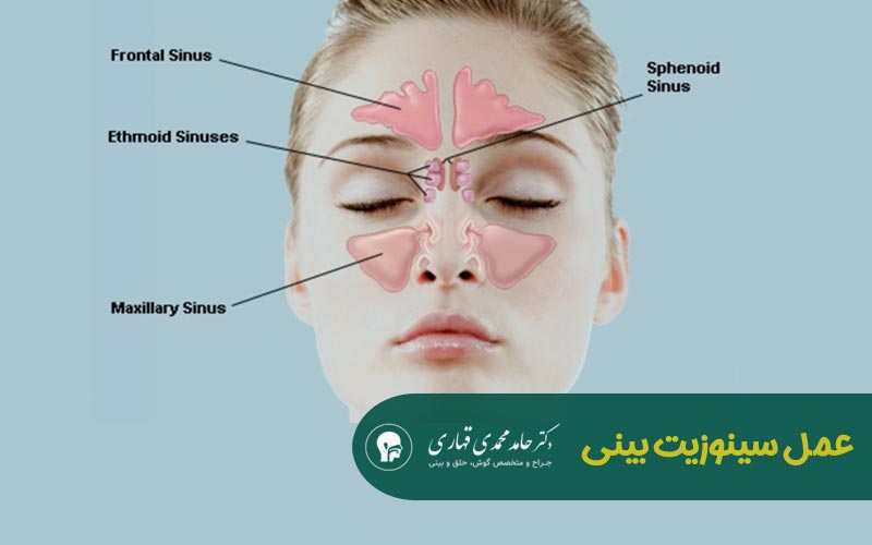 عمل سینوزیت بینی