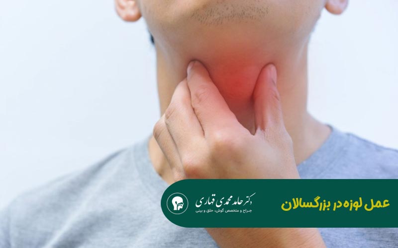 عمل لوزه در بزرگسالان 1 عمل لوزه در بزرگسالان