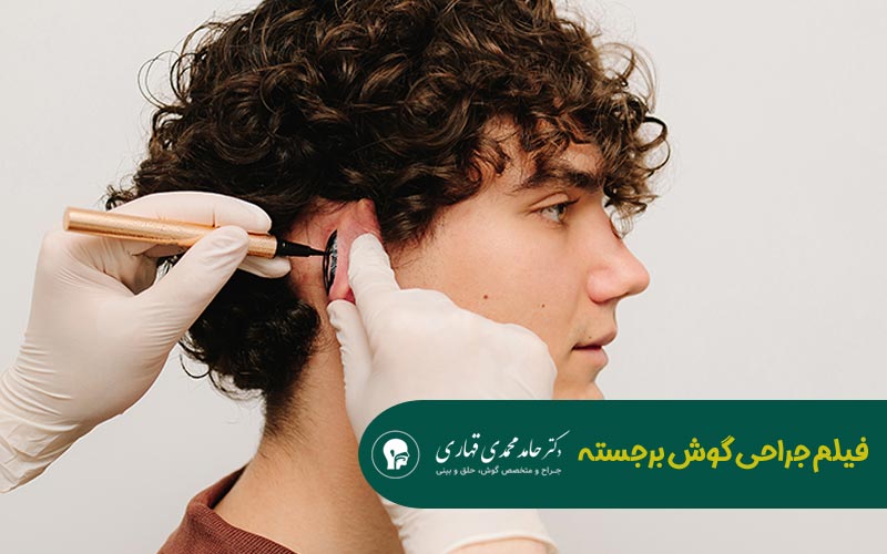 فیلم جراحی گوش برجسته