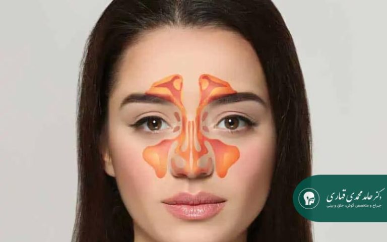 سینوزیت چیست و چگونه ایجاد می‌شود؟
