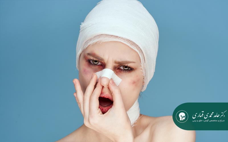مراقبت های بعد از عمل بینی برای کاهش ورم