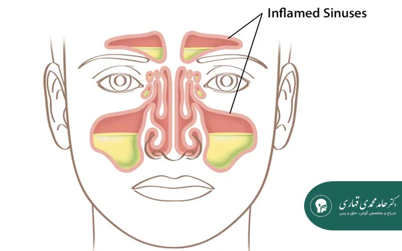 روش‌های تشخیص از معاینه تا تصویربرداری