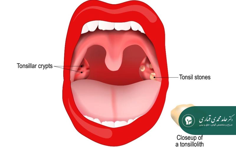 درمان‌های دارویی و مداخلات پزشکی غیرتهاجمی