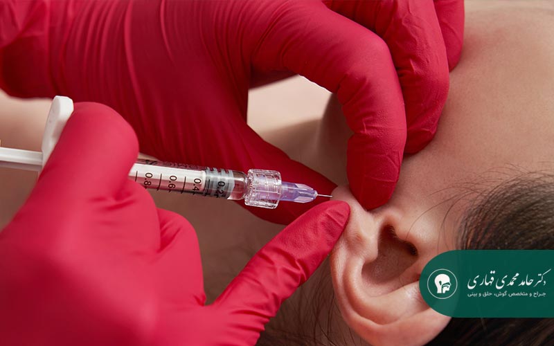 جراحی ترمیم نرمه گوش 6 هزینه جراحی ترمیم نرمه گوش در سال ۱۴۰۴