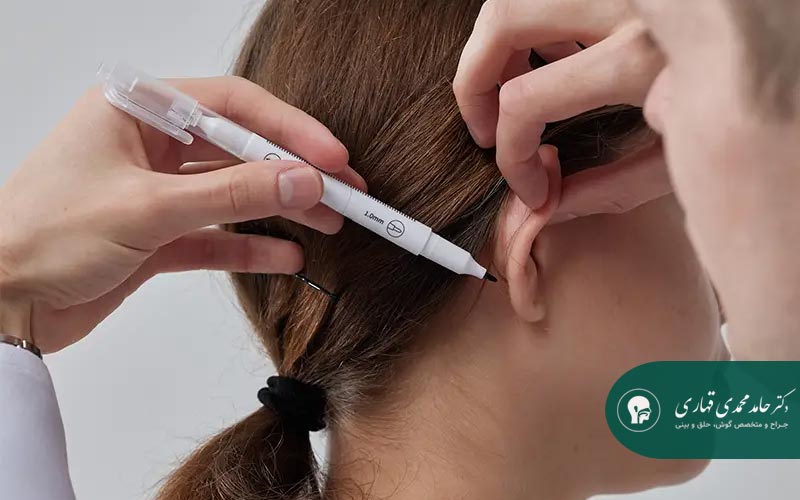 جراحی ترمیمی اتوپلاستی