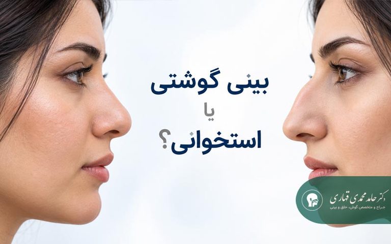 بینی گوشتی یا استخوانی