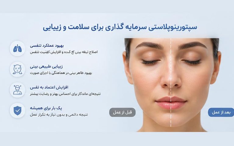 هزینه عمل سپتوپلاستی
