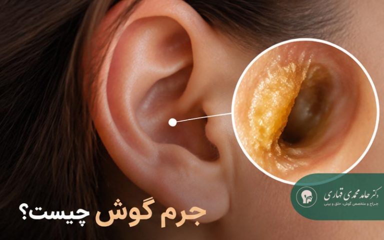 جرم گوش چیست