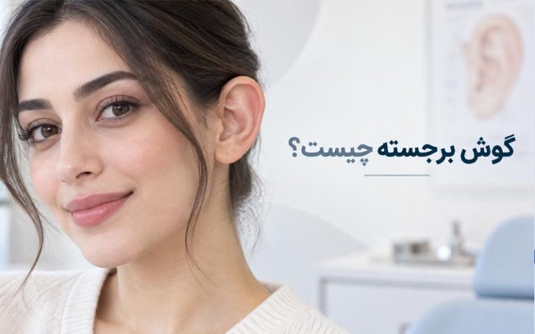 گوش برجسته چیست؟