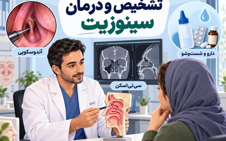 تشخبص سینوزیت