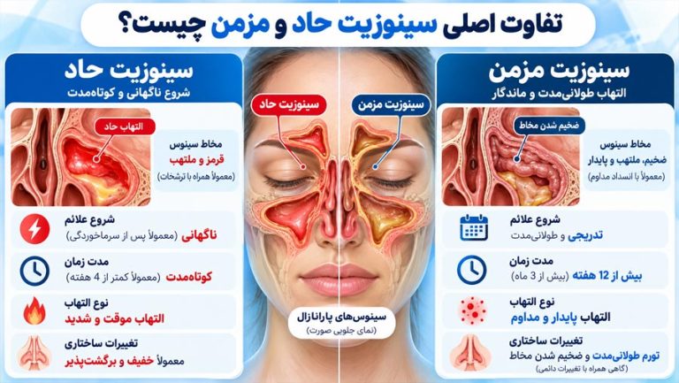 تفاوت اصلی سینوزیت حاد و مزمن چیست؟