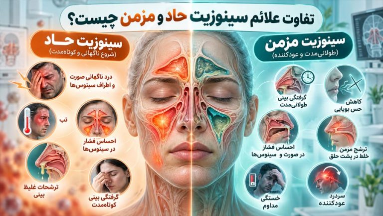 تفاوت علائم سینوزیت حاد و مزمن چیست؟