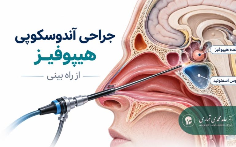 جراحی آندوسکوپی هیپوفیز از راه بینی چگونه است