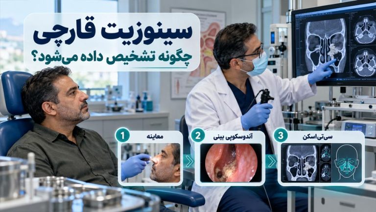 سینوزیت قارچی چگونه تشخیص داده می‌شود؟