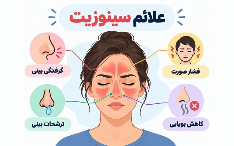 علائم سینوزیت