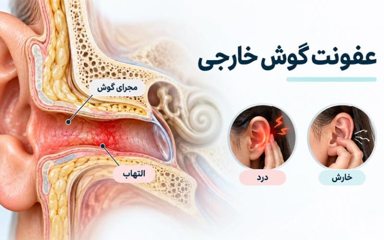علائم عفونت گوش خارجی
