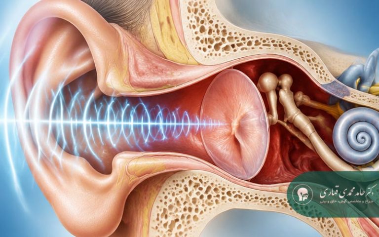 علائم پارگی پرده گوش چیست؟