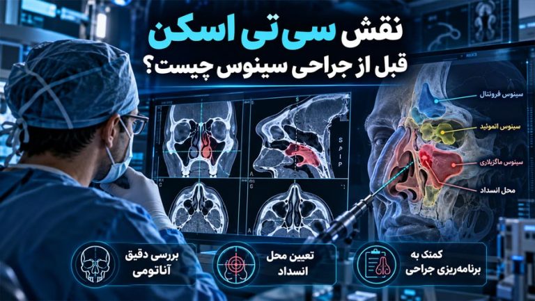 نقش سی تی اسکن قبل از جراحی سینوس چیست
